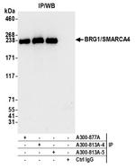 BRG1/SMARCA4 Antibody in Immunoprecipitation (IP)