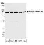 BRG1/SMARCA4 Antibody in Western Blot (WB)