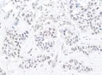 TIF1 Alpha/TRIM24 Antibody in Immunohistochemistry (Paraffin) (IHC (P))