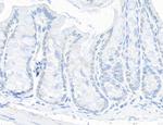 TIF1 Alpha/TRIM24 Antibody in Immunohistochemistry (Paraffin) (IHC (P))