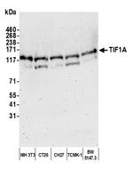 TIF1 Alpha/TRIM24 Antibody in Western Blot (WB)