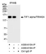 TIF1 Alpha/TRIM24 Antibody in Immunoprecipitation (IP)