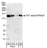 TIF1 Alpha/TRIM24 Antibody in Western Blot (WB)