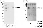 ASPP2 Antibody in Western Blot (WB)