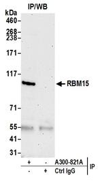 RBM15 Antibody in Immunoprecipitation (IP)