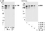 TPR Antibody in Western Blot (WB)