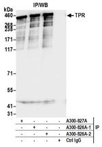 TPR Antibody in Immunoprecipitation (IP)