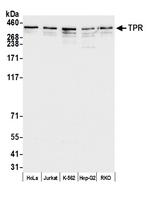 TPR Antibody in Western Blot (WB)