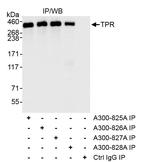 TPR Antibody in Immunoprecipitation (IP)