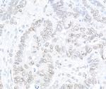 TPR Antibody in Immunohistochemistry (Paraffin) (IHC (P))