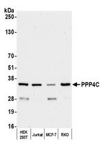 PPP4C Antibody in Western Blot (WB)