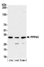 PPP4C Antibody in Western Blot (WB)