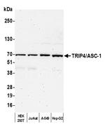 TRIP4/ASC-1 Antibody in Western Blot (WB)