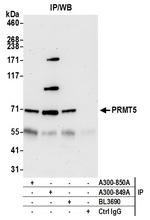 PRMT5 Antibody in Immunoprecipitation (IP)