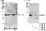 PRMT5 Antibody in Western Blot (WB)