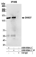 DHX37 Antibody in Immunoprecipitation (IP)