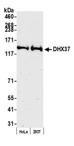 DHX37 Antibody in Western Blot (WB)