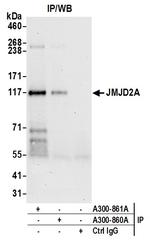 JMJD2A Antibody in Immunoprecipitation (IP)