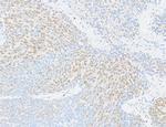 FOX2/RBM9 Antibody in Immunohistochemistry (Paraffin) (IHC (P))