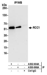 RCC1 Antibody in Immunoprecipitation (IP)