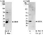 CBX5 Antibody in Western Blot (WB)