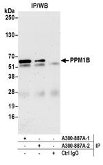 PPM1B Antibody in Immunoprecipitation (IP)