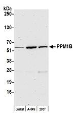 PPM1B Antibody in Western Blot (WB)