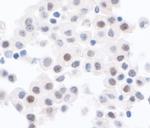 PPP1CA Antibody in Immunohistochemistry (Paraffin) (IHC (P))