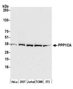 PPP1CA Antibody in Western Blot (WB)