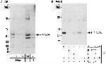 PPP3CA Antibody in Western Blot (WB)