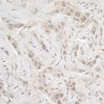 PPP3CA Antibody in Immunohistochemistry (Paraffin) (IHC (P))