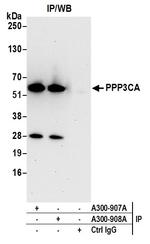 PPP3CA Antibody in Immunoprecipitation (IP)