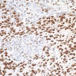 MTA1 Antibody in Immunohistochemistry (Paraffin) (IHC (P))