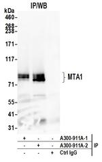 MTA1 Antibody in Immunoprecipitation (IP)