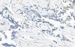 KIF14 Antibody in Immunohistochemistry (Paraffin) (IHC (P))