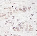 BCAS3 Antibody in Immunohistochemistry (Paraffin) (IHC (P))