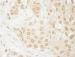 USP33 Antibody in Immunohistochemistry (Paraffin) (IHC (P))