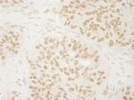 USP33 Antibody in Immunohistochemistry (Paraffin) (IHC (P))