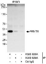 PRMT6 Antibody in Immunoprecipitation (IP)