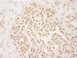 PRMT6 Antibody in Immunohistochemistry (Paraffin) (IHC (P))