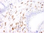 Coronin 1 Antibody in Immunohistochemistry (Paraffin) (IHC (P))