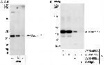 Coronin 1 Antibody in Western Blot (WB)