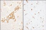 Coronin 1 Antibody in Immunohistochemistry (Paraffin) (IHC (P))