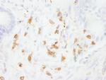 Coronin 1 Antibody in Immunohistochemistry (Paraffin) (IHC (P))