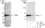 Coronin 1 Antibody in Western Blot (WB)