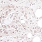 Geminin Antibody in Immunohistochemistry (Paraffin) (IHC (P))