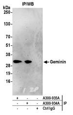 Geminin Antibody in Immunoprecipitation (IP)