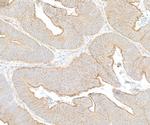 SPTBN1 Antibody in Immunohistochemistry (Paraffin) (IHC (P))