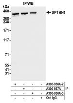 SPTBN1 Antibody in Immunoprecipitation (IP)