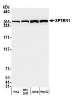 SPTBN1 Antibody in Western Blot (WB)